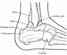 broken heel bone